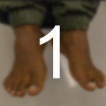 A photo of a person's feet with a large number 1 in the centre.