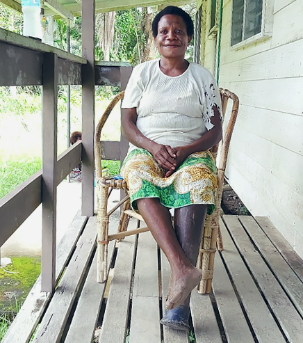 Monica sitting on a porch with her right leg crossed over her prosthetic left leg, smiling.
