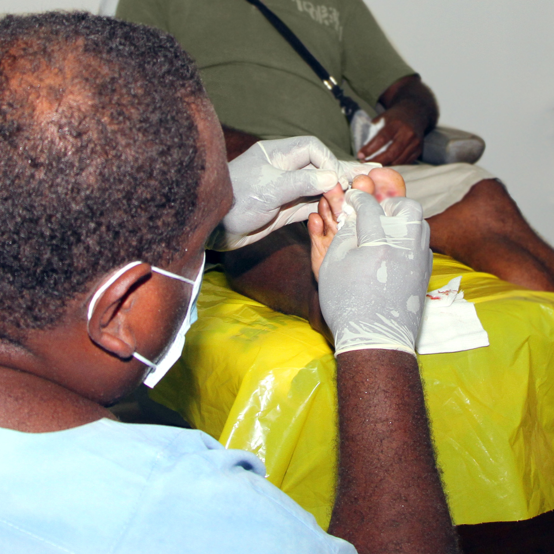 A health worker wearing gloves and a facemask cleans a man's foot wounds.