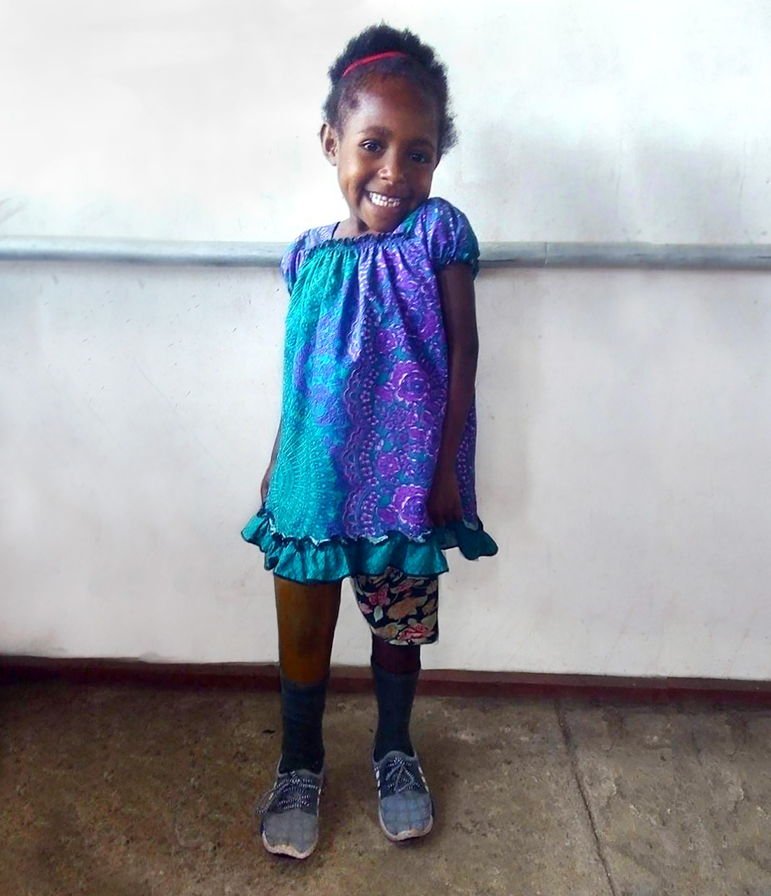 Violet standing proudly with her new prosthesis, beaming at the camera.